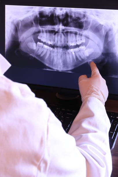 Best Emergency Root Canal Treatment in Wilmington Island, GA