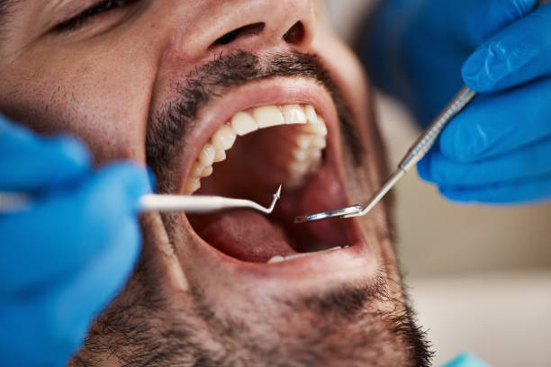 Best Mobile Emergency Dentist in Wilmington Island, GA